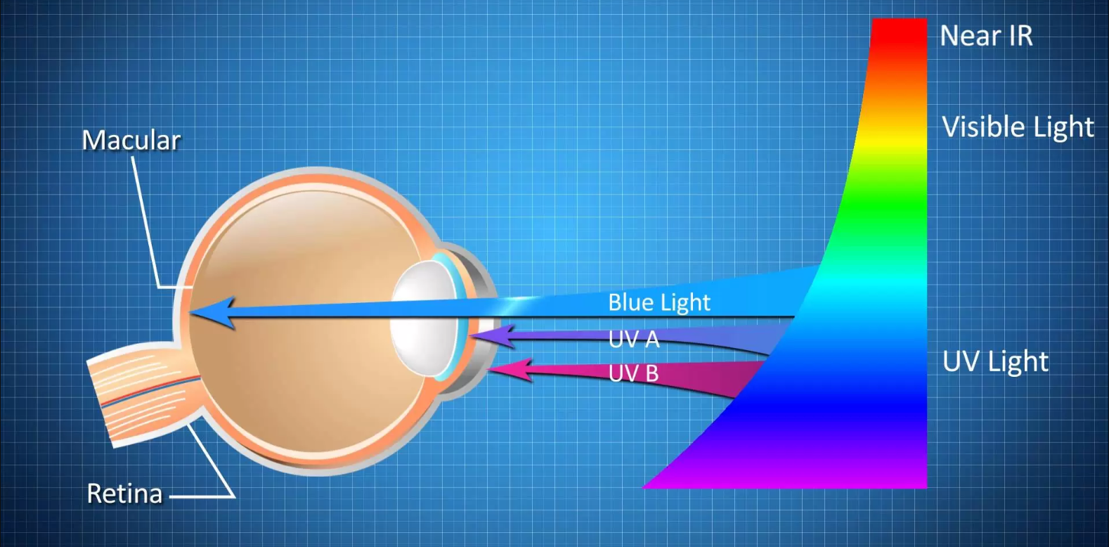 Blue-Light & Harmful effects on Eyes